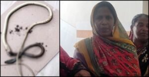 দংশনের শিকার নারী সাপ নিয়েই হাসপাতালে